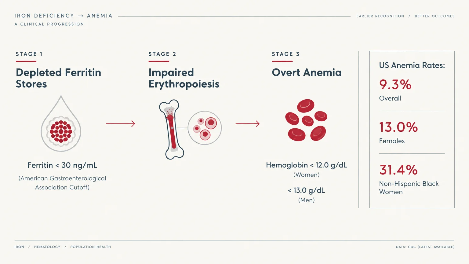 Diagram showing three stages from depleted ferritin stores to overt anemia alongside US anemia rate statistics.